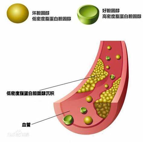二、“高血脂”的危害图片1.jpg
